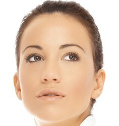 Woman's face after rhinoplasty
