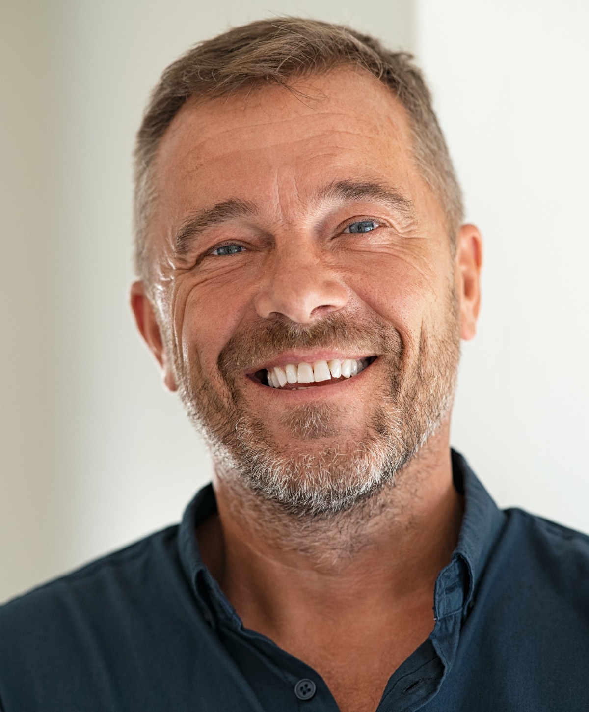 Smiling Middle Aged Facelift Patient